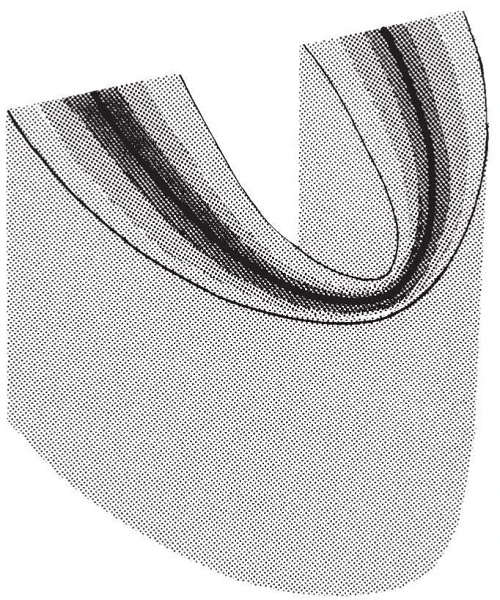 Hình 6. Máng tiêu cự. Tâm của máng tiêu cự càng gần (dải đen) vị trí một cấu trúc giải phẫu thì hình ảnh kết quả trên phim X quang càng rõ