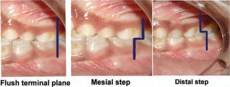 Sự phát triển của bộ răng: giai đoạn răng sữa (phần 2) - 19 file