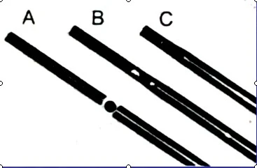 mui-khoan-nha-khoa-1