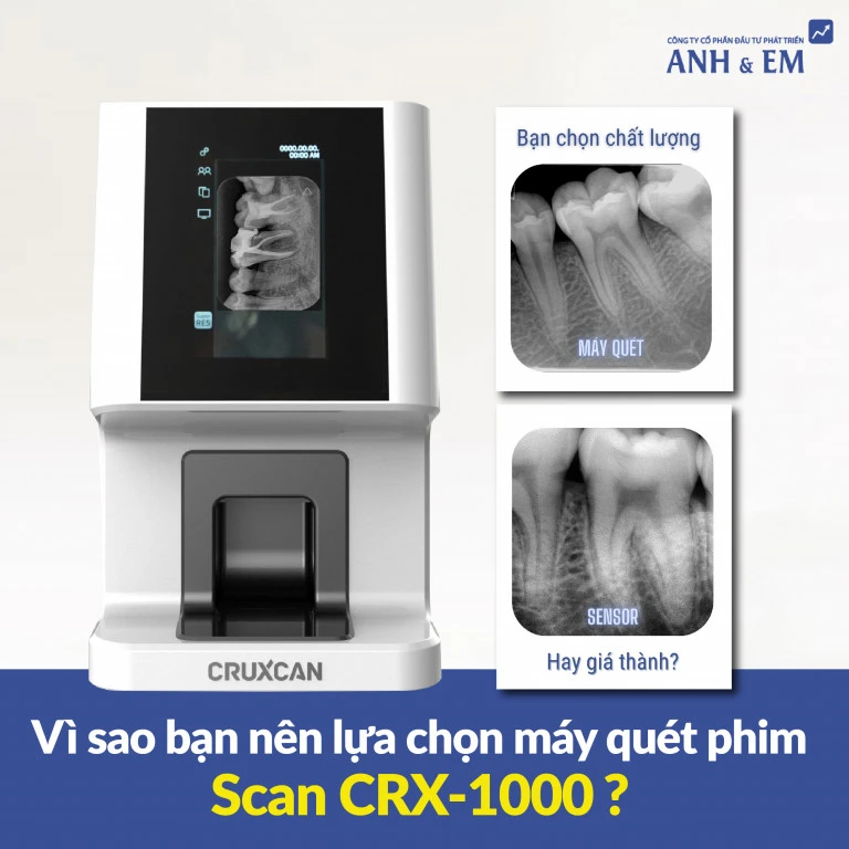 may-quet-phim-ky-thuat-so