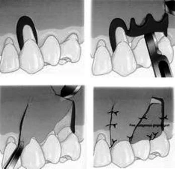 Các vấn đề về giải phẫu và mô học