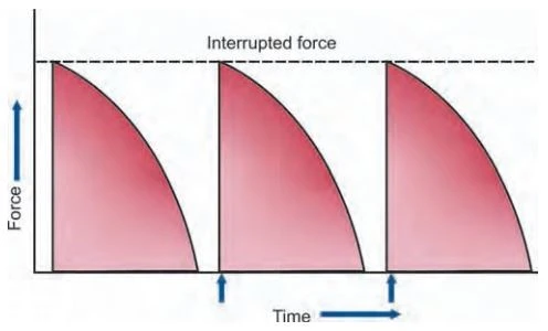Cơ học di chuyển răng trong chỉnh nha – ứng dụng - 304 file