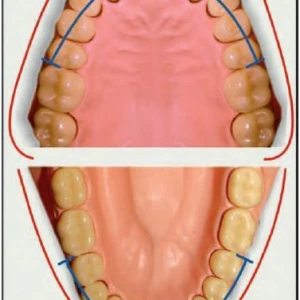 Chỉnh nha ( phần 17) - 31 file