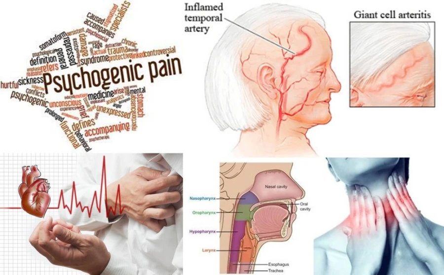 Nguồn gốc của đau răng không do răng