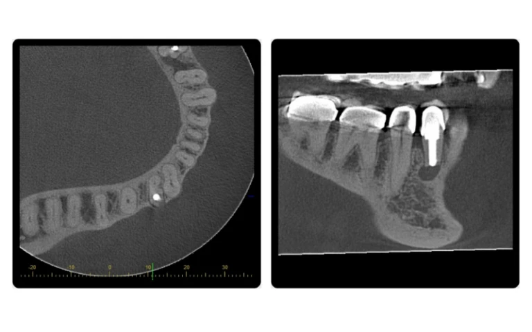 CBCT-trong-noi-nha
