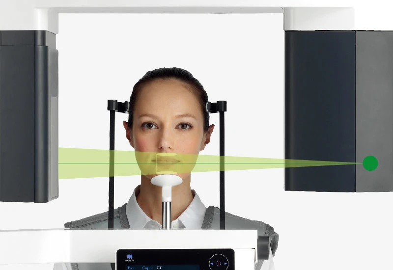 Đánh giá 10 thiết bị chụp CBCT trong nội nha