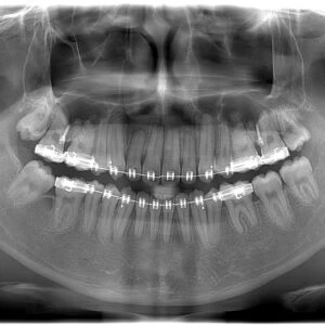 X-quang-toan-ham-IC5