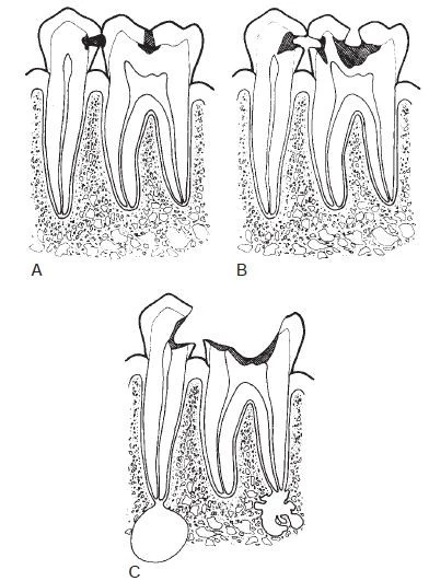 Phim cánh cắn ban đầu