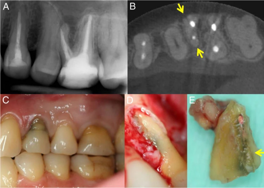 CBCT-trong-noi-nha
