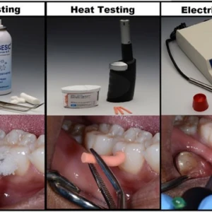 Các thử nghiệm : thử nghiệm tủy răng ( phần 1) - 9 file