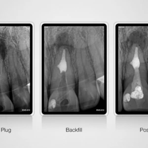 Top-10-CBCT-tot-nhat-the-gioi