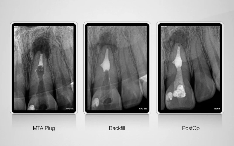 Top-10-CBCT-tot-nhat-the-gioi