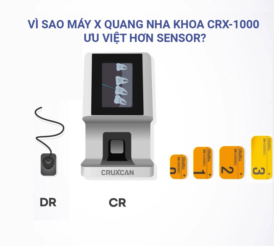 Vì sao máy quét phim CRX-1000 được đánh giá ưu việt hơn sensor? - Vi sao may chup x quang nha khoa crx 1000 duoc danh gia ...