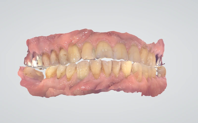 Máy quét trong miệng