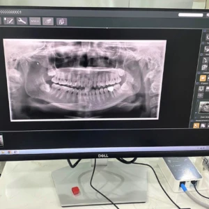 Phim toàn hàm được chụp bởi X-quang IC5 HD Morita