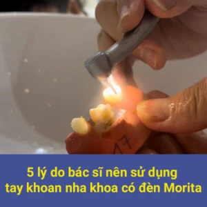 tay khoan có đèn morita