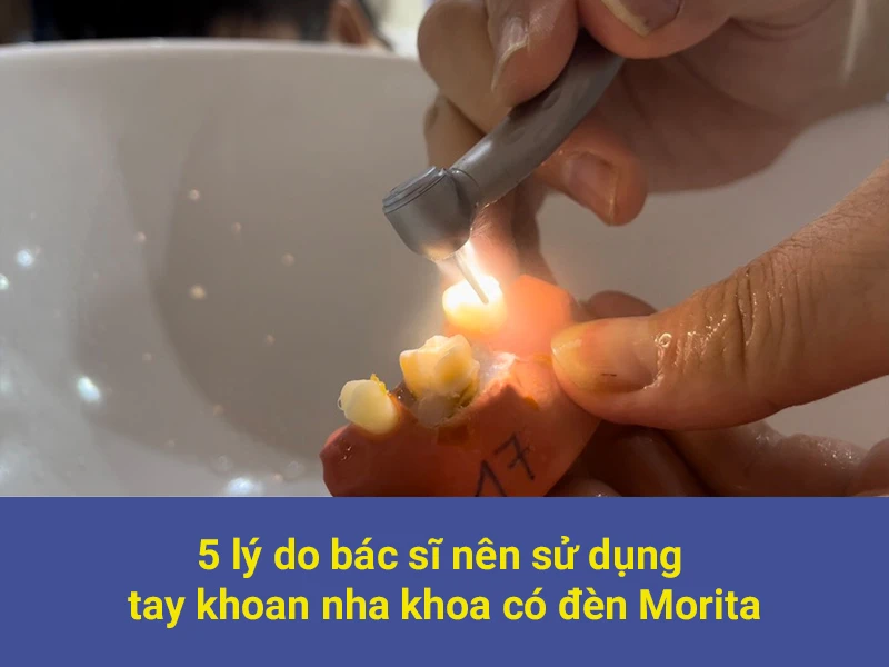 tay khoan có đèn morita
