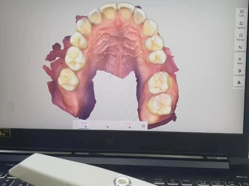 Phần mềm dễ vận hành và sử dụng bao giờ cũng được ưu tiên hơn