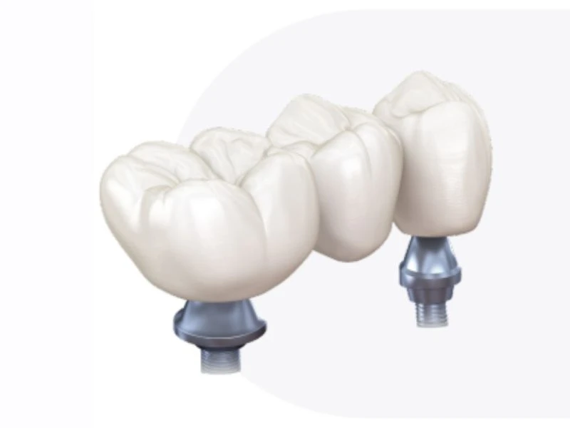 Hầu hết không bệnh nhân nào thích ngồi lâu trên ghế nha điều trị