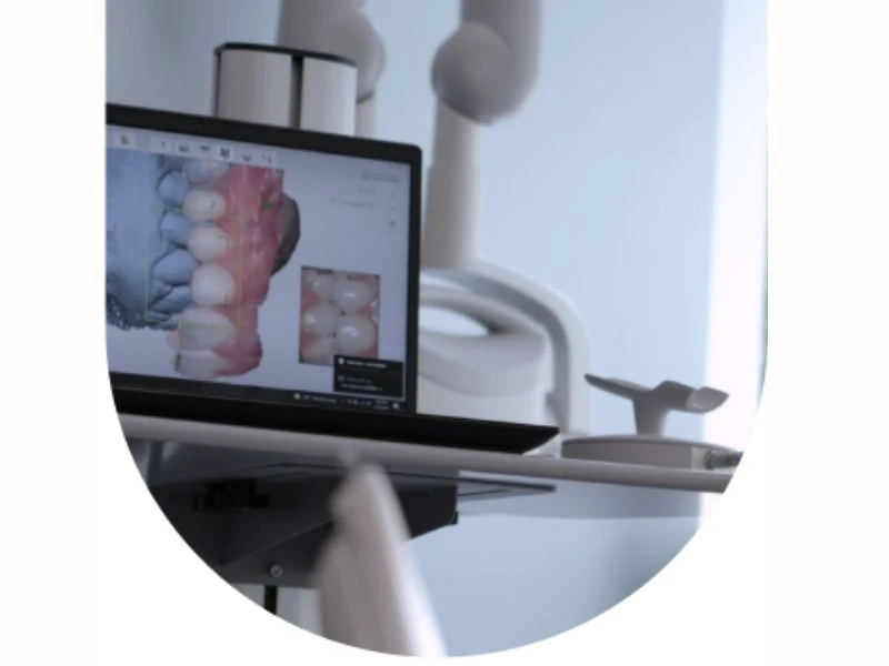 Kỹ thuật số nha khoa giúp tiết kiệm chi phí vật liệu và máy móc