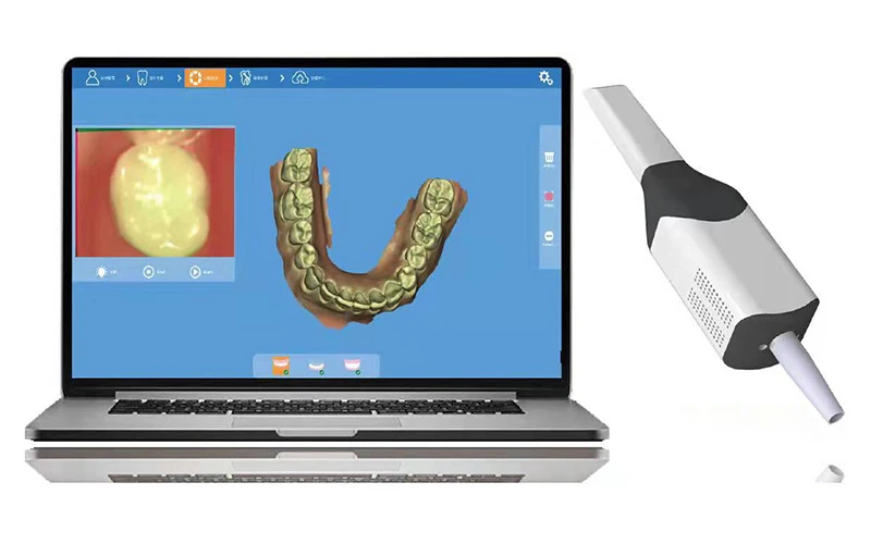 Máy quét trong miệng Panda P1