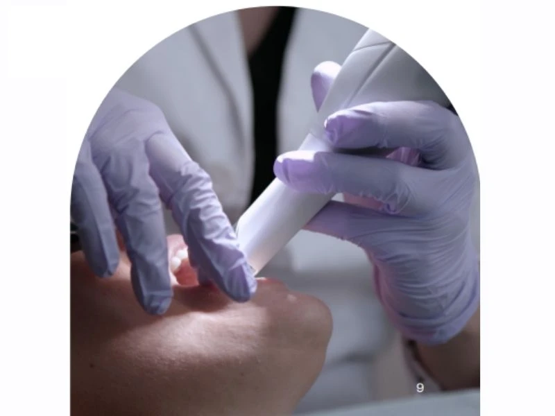 Máy quét trong miệng là bước đầu kỹ thuật số nha khoa