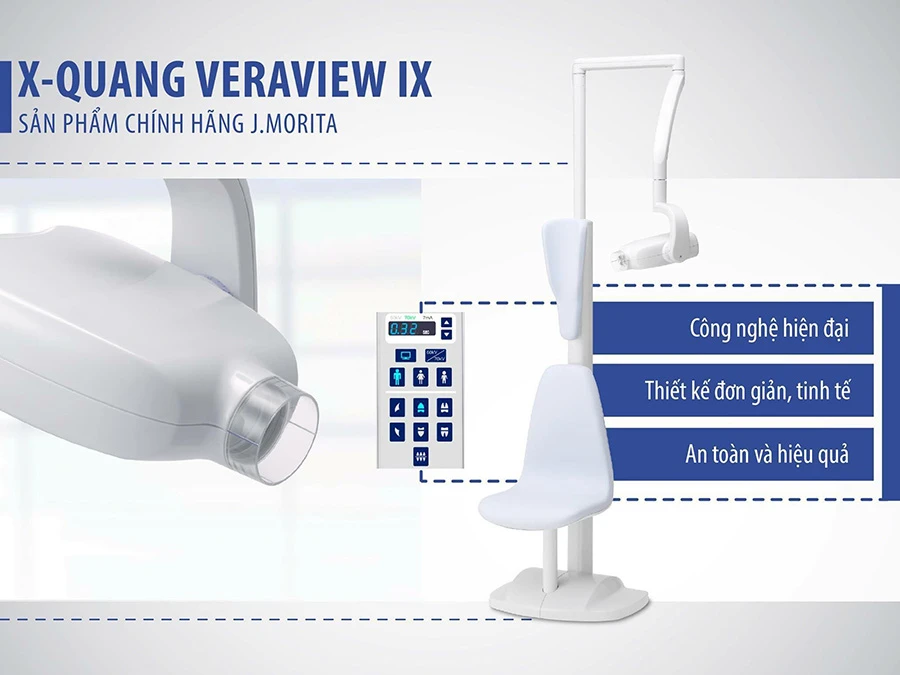 x quang cận chóp thay thế x quang cầm tay