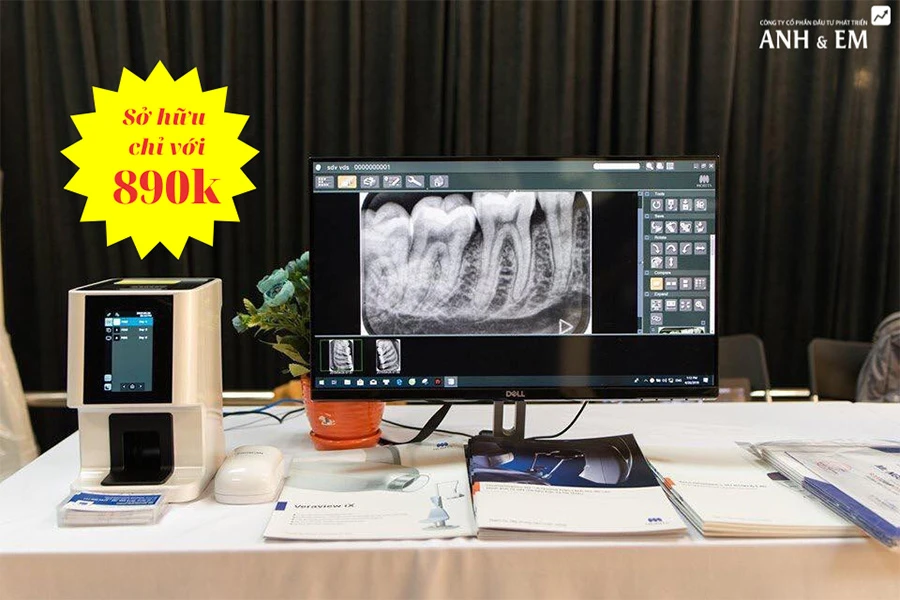 ưu đãi máy quét phim nha khoa