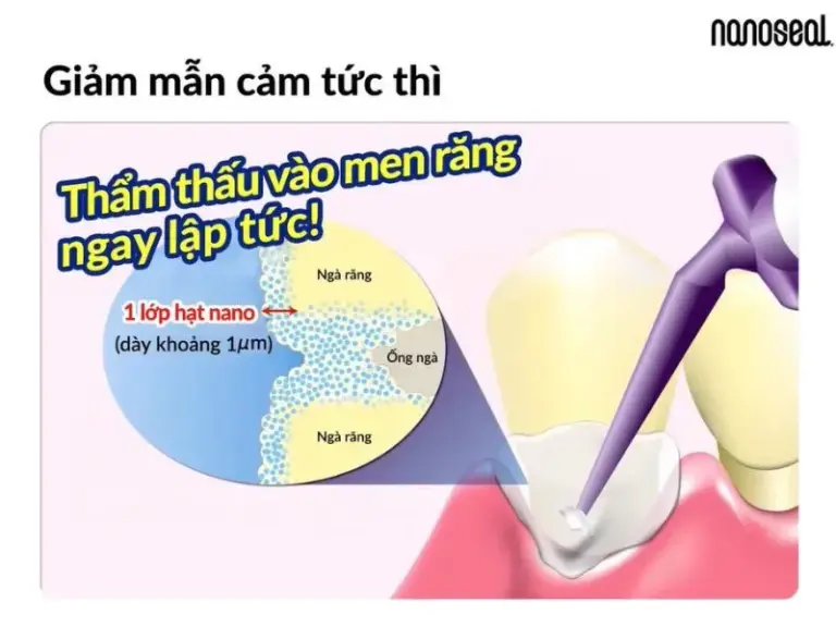 Blog nanoseal tham thau tuc thi
