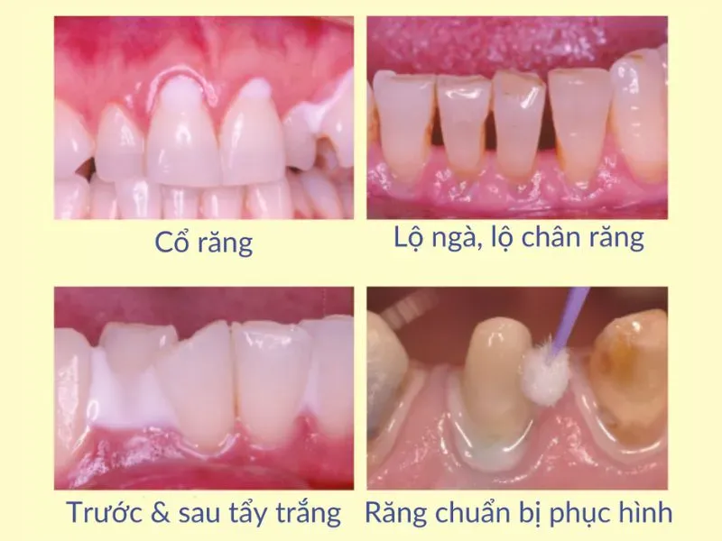 Blog nanoseal ung dung