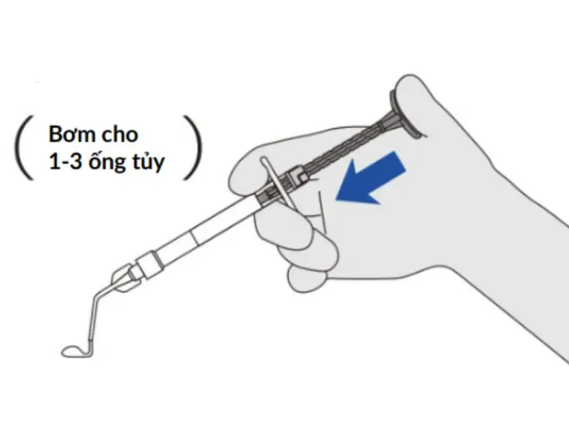 Calcipex II ngăn xả quá mức (2)
