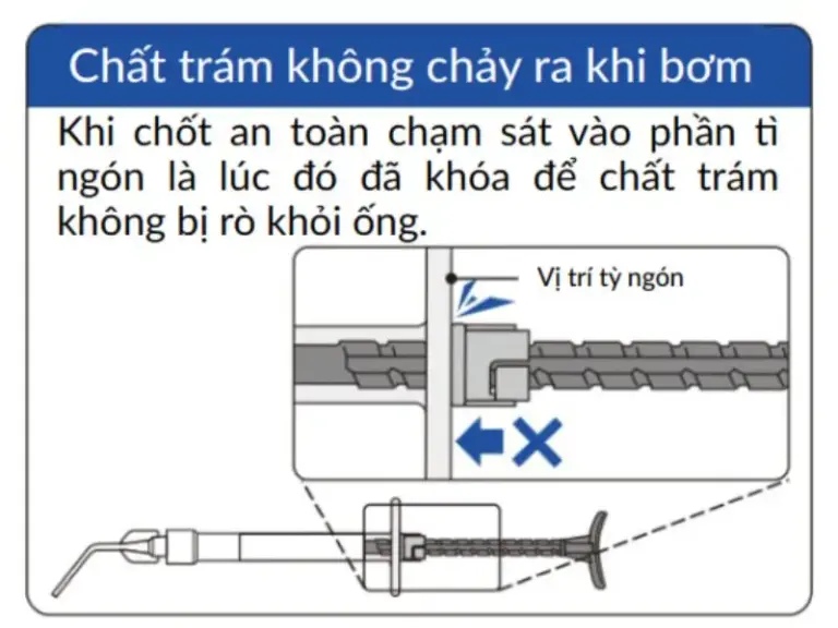 Calcipex II ngăn xả quá mức (3)