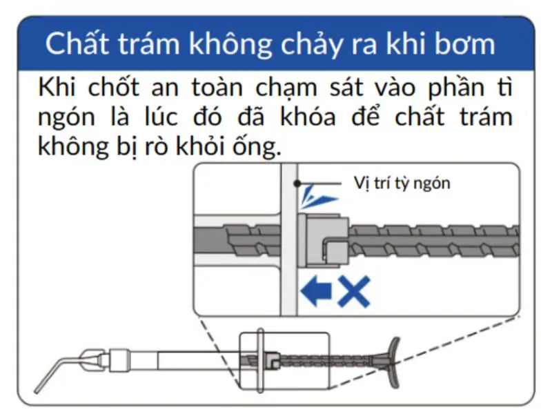 Calcipex II ngăn xả quá mức (3)