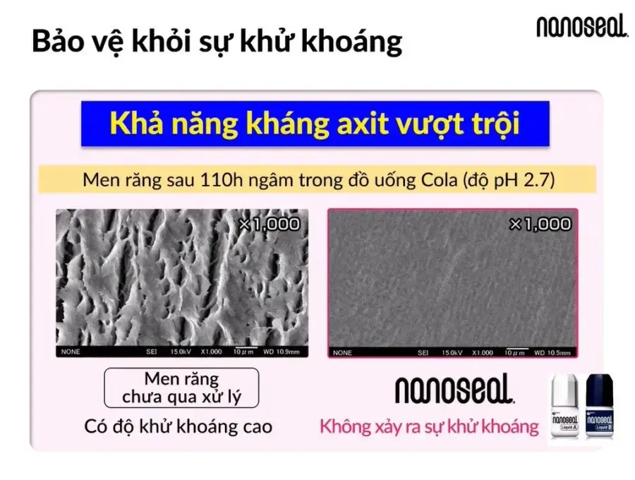 Nanoseal bảo vệ khỏi sự khử khoáng