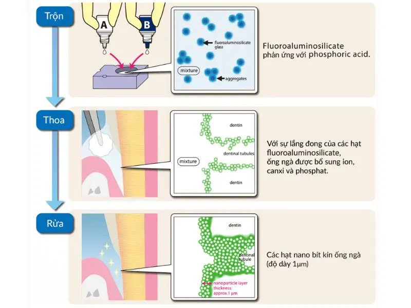 blog nanoseal 3 buoc bit ong nga