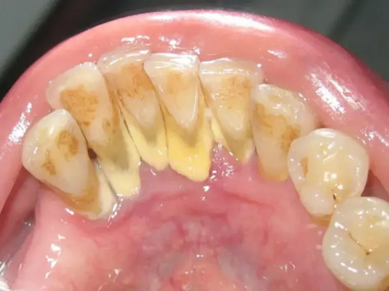 Màng sinh học biofilm