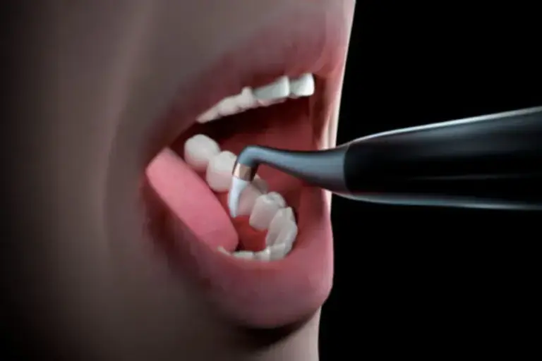 máy thổi cát nha khoa Quick Jet M