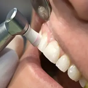 Xử lý màng biofilm