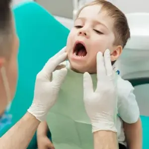 Răng sữa bị sâu có nên trám?