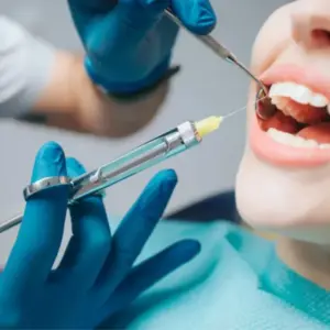 Ưu - nhược điểm của các dung dịch bơm rửa nội nha hiện nay - Uu nhuoc diem cua cac dung dich bom rua noi nha