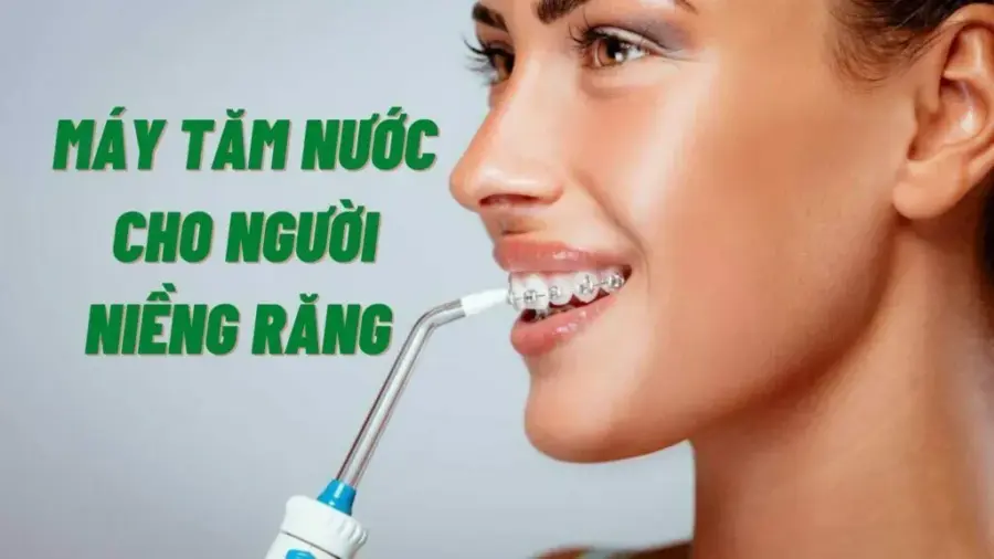 chăm sóc răng đúng cách