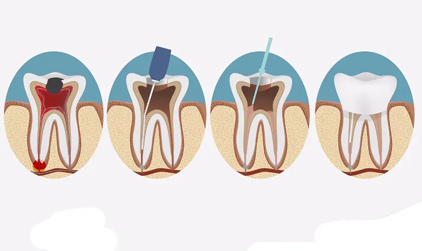 máy rung rửa siêu âm