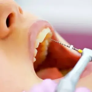 máy rung rửa siêu âm