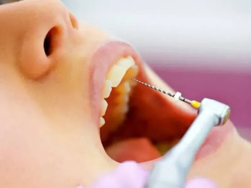 máy rung rửa siêu âm