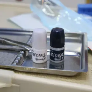 trị ê buốt răng tại nhà