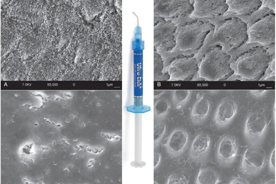 kỹ thuật etching