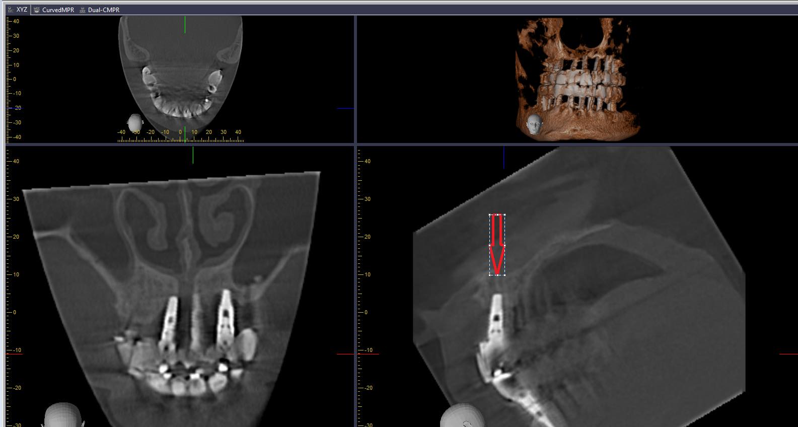 Su-that-ve-chat-luong-hinh-anh-cbct-va-nhung-dieu-luu-y-danh-cho-nha-si-1