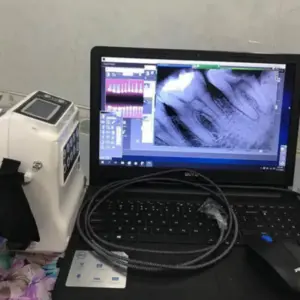 Thiết bị quét Sensor