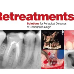 Các yếu tố tiên lượng sự thành công trong điều trị nội nha lại