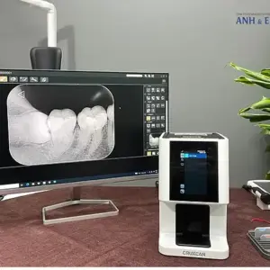 Hiệu năng chẩn đoán và độ nhạy của máy định vị chóp điện tử